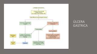 ÚLCERA
GASTRICA
 