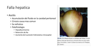 Falla hepatica
• Ascitis
• Acumulación del fluido en la cavidad peritoneal
• Cirrosis causa mas comun
• Sx nefrotico
• Patofisiologia
• Hipoalbuminemia
• Retención de Na
• Aumento de la presión hidrostatica intracapilar
 