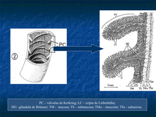 PC – válvulas de Kerkring; LC – cripta de Lieberkühn;
DG –glándula de Brünner; TM - mucosa; TS – submucosa; TMu – muscular; TSs - subserosa
 
