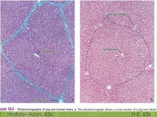 Mallory- Azan. 65x H-E. 65x
 