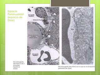 Microfotografía
electrónica de 2
sinusoides
hepáticos
6.6oox
Microfotografía electrónica en la que se ve el espacio
perisoidal (de Disse)
Espacio
Perisinusoidal
(espacio de
Disse)
 