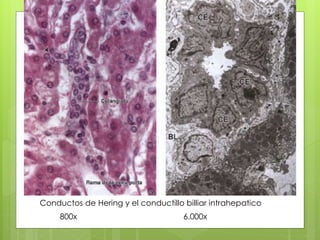 Conductos de Hering y el conductillo billiar intrahepatico
800x 6.000x
 