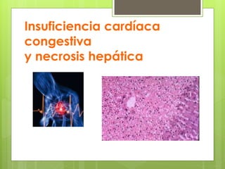 Insuficiencia cardíaca
congestiva
y necrosis hepática
 