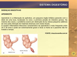 22
SISTEMA DIGESTÓRIOSISTEMA DIGESTÓRIO
DOENÇAS DIGESTIVAS
APENDICITE
Apendicite é a inflamação do apêndice, um pequeno órgão linfático parecido com o
dedo de uma luva, localizado no ceco, a primeira porção do intestino grosso. Na
maioria dos casos, o problema ocorre por obstrução da luz dessa pequena saliência
do ceco pela retenção de materiais diversos com restos fecais.
O quadro inflamatório-infeccioso característico da apendicite é mais frequente entre
20 e 30 anos e pode ser extremamente grave e levar à morte se o paciente não for
tratado a tempo.
FONTE: drauziovarella.com.br
 