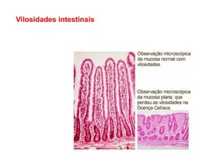 Vilosidades intestinais
 
