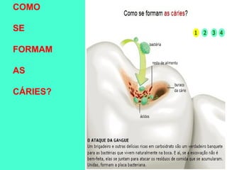 COMO

SE

FORMAM

AS

CÁRIES?
 
