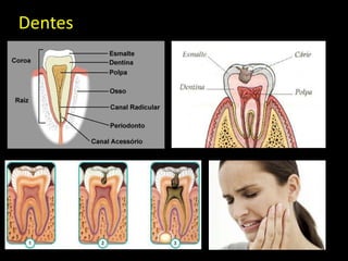 Dentes