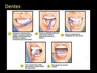 Dentes