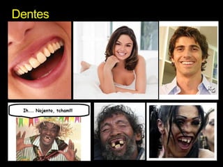 Dentes