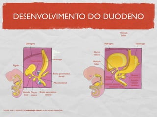 DESENVOLVIMENTO DO DUODENO
Diafragma
Estômago
Broto pancreático
dorsal
Alça duodenal
Broto pancreático
ventral
Ducto
cístico
Vesícula
biliar
Fígado
Diafragma Estômago
Ducto
cístico
Vesícula
biliar
Ducto biliar Vesícula
biliar
Ducto
colédoco
Intestino anterior
Intestino médio
Brotos
pancreáticos
dorsal e
ventral
fundidos
MOORE, Keith L., PERSAUD,TVN. Embriologia Clínica. 8 ed. Rio de Janeiro: Elsevier, 2008.
 