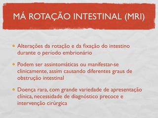 Alterações da rotação e da ﬁxação do intestino
durante o período embrionário
Podem ser assintomáticas ou manifestar-se
clinicamente, assim causando diferentes graus de
obstrução intestinal
Doença rara, com grande variedade de apresentação
clínica, necessidade de diagnóstico precoce e
intervenção cirúrgica
MÁ ROTAÇÃO INTESTINAL (MRI)
 
