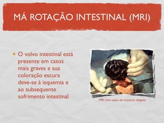 MÁ ROTAÇÃO INTESTINAL (MRI)
O volvo intestinal está
presente em casos
mais graves e sua
coloração escura
deve-se à isquemia e
ao subsequente
sofrimento intestinal MRI com volvo do intestino delgado
 
