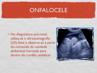 ONFALOCELE
No diagnóstico pré-natal,
utiliza-se a ultrassonograﬁa
(US) fetal e observa-se a parte
do conteúdo da cavidade
abdominal herniada para
dentro do cordão umbilical
 