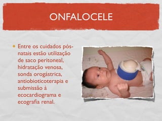 ONFALOCELE
Entre os cuidados pós-
natais estão utilização
de saco peritoneal,
hidratação venosa,
sonda orogástrica,
antiobioticoterapia e
submissão à
ecocardiograma e
ecograﬁa renal.
 