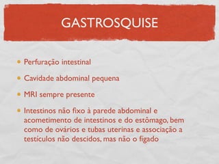 GASTROSQUISE
Perfuração intestinal
Cavidade abdominal pequena
MRI sempre presente
Intestinos não ﬁxo à parede abdominal e
acometimento de intestinos e do estômago, bem
como de ovários e tubas uterinas e associação a
testículos não descidos, mas não o fígado
 