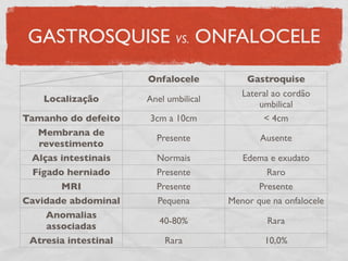 GASTROSQUISE VS. ONFALOCELE
Onfalocele Gastroquise
Localização Anel umbilical
Lateral ao cordão
umbilical
Tamanho do defeito 3cm a 10cm < 4cm
Membrana de
revestimento
Presente Ausente
Alças intestinais Normais Edema e exudato
Fígado herniado Presente Raro
MRI Presente Presente
Cavidade abdominal Pequena Menor que na onfalocele
Anomalias
associadas
40-80% Rara
Atresia intestinal Rara 10,0%
 