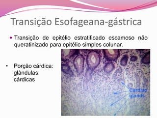 Transição Esofageana-gástrica
 Transição de epitélio estratificado escamoso não
queratinizado para epitélio simples colunar.
• Porção cárdica:
glândulas
cárdicas
 