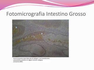 Fotomicrografia Intestino Grosso
 