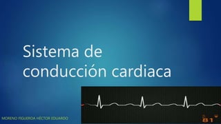 Sistema de
conducción cardiaca
MORENO FIGUEROA HÉCTOR EDUARDO
 