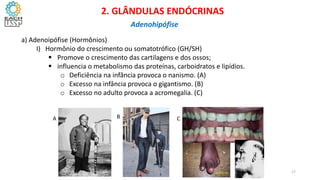 a) Adenoipófise (Hormônios)
I) Hormônio do crescimento ou somatotrófico (GH/SH)
 Promove o crescimento das cartilagens e dos ossos;
 influencia o metabolismo das proteínas, carboidratos e lipídios.
o Deficiência na infância provoca o nanismo. (A)
o Excesso na infância provoca o gigantismo. (B)
o Excesso no adulto provoca a acromegalia. (C)
A B C
CIÊNCIAS, 8º Ano do Ensino Fundamental
Glândulas e suas funções
CIÊNCIAS, 8º Ano do Ensino Fundamental
Glândulas e suas funções
2. GLÂNDULAS ENDÓCRINAS
Adenohipófise
17
 