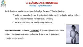 Deficiência na produção dos hormônios T3 e Tiroxina (T4) pela tireoide:
 pode ser causada devido à carência de iodo na alimentação, pois o iodo é
parte constituinte dos hormônios da tireoide;
 destruição autoimune da tireoide (tireoidite).
CIÊNCIAS, 8º Ano do Ensino Fundamental
Glândulas e suas funções
CIÊNCIAS, 8º Ano do Ensino Fundamental
Glândulas e suas funções
CIÊNCIAS, 8º Ano do Ensino Fundamental
Glândulas e suas funções
CIÊNCIAS, 8º Ano do Ensino Fundamental
Glândulas e suas funções
CIÊNCIAS, 8º Ano do Ensino Fundamental
Glândulas e suas funções
CIÊNCIAS, 8º Ano do Ensino Fundamental
Glândulas e suas funções
CIÊNCIAS, 8º Ano do Ensino Fundamental
Glândulas e suas funções
CIÊNCIAS, 8º Ano do Ensino Fundamental
Glândulas e suas funções
2. GLÂNDULAS ENDÓCRINAS
Tireóide - Hipotireoidismo
Hipotireoidismo na infância: Cretinismo  quadro que se caracteriza
pelo comprometimento do crescimento dos ossos e dos dentes e
retardamento mental.
25
 