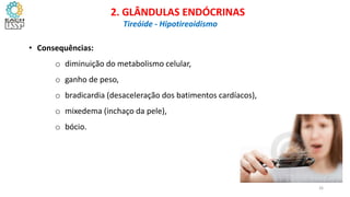 • Consequências:
o diminuição do metabolismo celular,
o ganho de peso,
o bradicardia (desaceleração dos batimentos cardíacos),
o mixedema (inchaço da pele),
o bócio.
CIÊNCIAS, 8º Ano do Ensino Fundamental
Glândulas e suas funções
CIÊNCIAS, 8º Ano do Ensino Fundamental
Glândulas e suas funções
CIÊNCIAS, 8º Ano do Ensino Fundamental
Glândulas e suas funções
CIÊNCIAS, 8º Ano do Ensino Fundamental
Glândulas e suas funções
CIÊNCIAS, 8º Ano do Ensino Fundamental
Glândulas e suas funções
CIÊNCIAS, 8º Ano do Ensino Fundamental
Glândulas e suas funções
CIÊNCIAS, 8º Ano do Ensino Fundamental
Glândulas e suas funções
CIÊNCIAS, 8º Ano do Ensino Fundamental
Glândulas e suas funções
2. GLÂNDULAS ENDÓCRINAS
Tireóide - Hipotireoidismo
26
 