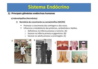 Sistema Endócrino
2) Principais glândulas endócrinas humanas
a) Adenohipófise (Hormônios)
I) Hormônio do crescimento ou somatotrófico (GH/SH)
Promove o crescimento das cartilagens e dos ossos
Influencia o metabolismo das proteínas, carboidratos e lipídios.
o Deficiência na infância provoca o nanismo. (A)
o Excesso na infância provoca o gigantismo. (B)
o Excesso no adulto provoca a acromegalia. (C)
A B
C
 
