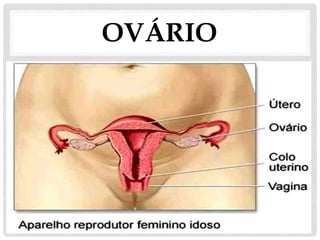 OVÁRIO
 