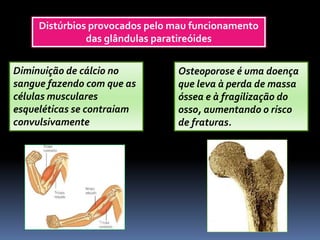 Distúrbios provocados pelo mau funcionamento
das glândulas paratireóides
Diminuição de cálcio no
sangue fazendo com que as
células musculares
esqueléticas se contraiam
convulsivamente
Osteoporose é uma doença
que leva à perda de massa
óssea e à fragilização do
osso, aumentando o risco
de fraturas.
 