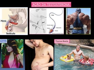 AÇÃO DA TESTOSTERONA
Thomas BeatieTracy
 