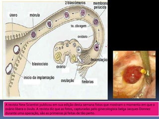 A revista New Scientist publicou em sua edição desta semana fotos que mostram o momento em que o
ovário libera o óvulo. A revista diz que as fotos, capturadas pelo ginecologista belga Jacques Donnez
durante uma operação, são as primeiras já feitas de tão perto.
 