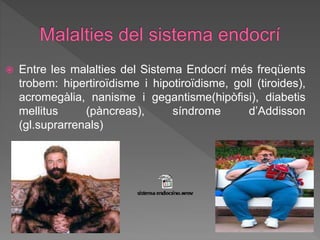  Entre les malalties del Sistema Endocrí més freqüents
trobem: hipertiroïdisme i hipotiroïdisme, goll (tiroides),
acromegàlia, nanisme i gegantisme(hipòfisi), diabetis
mellitus (pàncreas), síndrome d’Addisson
(gl.suprarrenals)
 