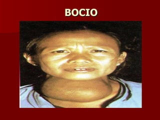 BOCIO 