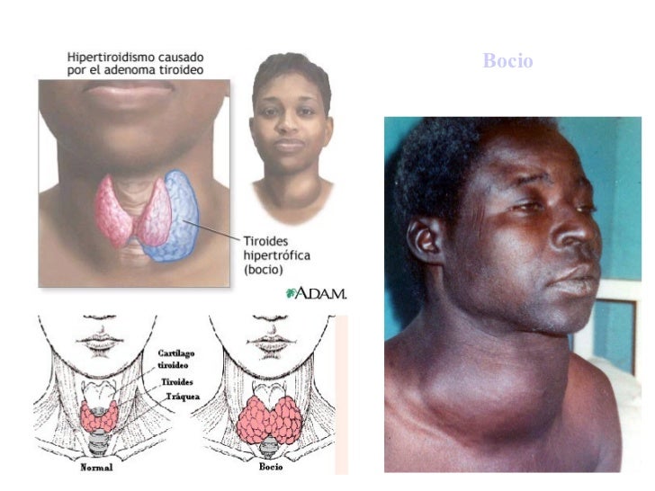 Sistema Endocrino