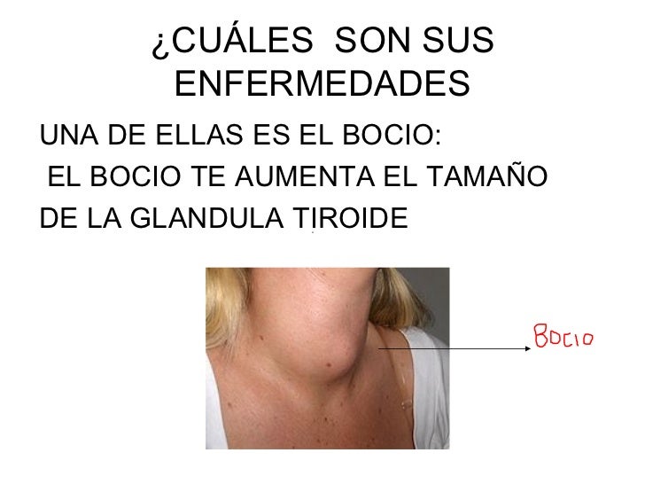 Sistema Endocrino