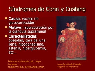 Síndromes de Conn y CushingSíndromes de Conn y Cushing
 CausaCausa: exceso de: exceso de
glucocorticoidesglucocorticoides
 MotivoMotivo: hipersecreción por: hipersecreción por
la glándula suprarrenalla glándula suprarrenal
 CaracterísticasCaracterísticas ::
obesidad, cara de lunaobesidad, cara de luna
llena, hipogonadismo,llena, hipogonadismo,
astenia, hiperglucemia,astenia, hiperglucemia,
etc…etc…
Juan Carreño de Miranda:
Eugenia “La monstrua”
Estructura y función del cuerpo
humano.
McGRAW-HILL. INTERAMERICANA
 