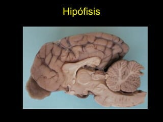 Hipófisis
 
