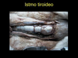 Istmo tiroideo
 