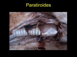 Paratiroides
 