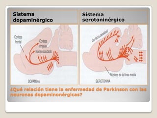Sistema                    Sistema
 dopaminérgico              serotoninérgico




¿Qué relación tiene la enfermedad de Parkinson con las
neuronas dopaminonérgicas?
 