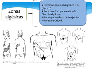 Zonas
algésicas
Hemicinturon hiperalgésico Izq.
(Katsch)
Zona coledocopancreatica de
Chauffard y Rivet
Punto pancreático de Desjardins
Punto de Orlowki
 