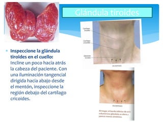 Inspeccione la glándula
tiroides en el cuello:
Incline un poco hacia atrás
la cabeza del paciente. Con
una iluminación tangencial
dirigida hacia abajo desde
el mentón, inspeccione la
región debajo del cartílago
cricoides.
Glándula tiroides
 