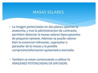 MASAS SELARES
 La imagen potenciadas en dos planos aportan la
anatomia, y tras la administracion de contraste,
permiten detectar la masas selares hipocaptantes
de pequeno tamano. Ademas se puede valorar
bien la extencion infraselar, supraselar o
paraselar de la masas y la posible
compresion/afectacion quiasmatica asociada.
 Tambien se estan comenzando a utilizar la
IMAGENES POTENCIADAS EN DIFUSION.
 