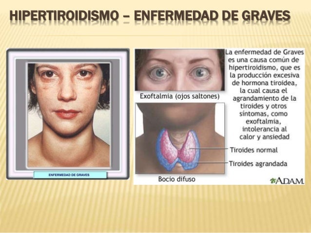 Sistema Endocrino