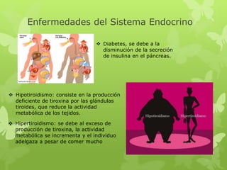 Enfermedades del Sistema Endocrino
 Diabetes, se debe a la
disminución de la secreción
de insulina en el páncreas.
 Hipotiroidismo: consiste en la producción
deficiente de tiroxina por las glándulas
tiroides, que reduce la actividad
metabólica de los tejidos.
 Hipertiroidismo: se debe al exceso de
producción de tiroxina, la actividad
metabólica se incrementa y el individuo
adelgaza a pesar de comer mucho
 