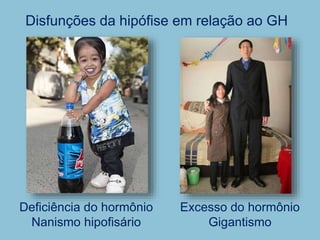 Disfunções da hipófise em relação ao GH
Deficiência do hormônio
Nanismo hipofisário
Excesso do hormônio
Gigantismo
 