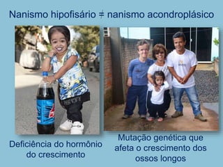 Nanismo hipofisário = nanismo acondroplásico
Deficiência do hormônio
do crescimento
Mutação genética que
afeta o crescimento dos
ossos longos
 