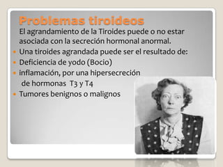 Problemas tiroideos
    El agrandamiento de la Tiroides puede o no estar
    asociada con la secreción hormonal anormal.
   Una tiroides agrandada puede ser el resultado de:
   Deficiencia de yodo (Bocio)
   inflamación, por una hipersecreción
     de hormonas T3 y T4
   Tumores benignos o malignos
 