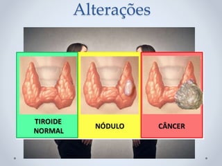 Alterações
 