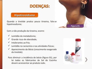 HHHHiiiippppoooottttiiiirrrreeeeooooiiiiddddiiiissssmmmmoooo 
Quando a tireóide produz pouca tiroxina, fala-se 
hipotireodismo; 
Com a não produção da tiroxina, ocorre: 
 Lentidão do metabolismo; 
 Grande risco de obesidade; 
 Intolerantes ao frio; 
 Lentidão no raciocínio e nas atividades físicas; 
 Aparecimento do Bócio (crescimento exagerado 
da tireóide). 
Para diminuir a incidência de bócio (figura 01), por 
lei todos os fabricantes de Sal de Cozinha 
devem acrescentar ao produto iodo. 
FFFFiiiigggguuuurrrraaaa 00001111 
 